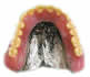コバルトクロム義歯　総入れ歯