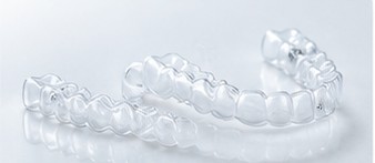 SureSmileの透明なマウスピース